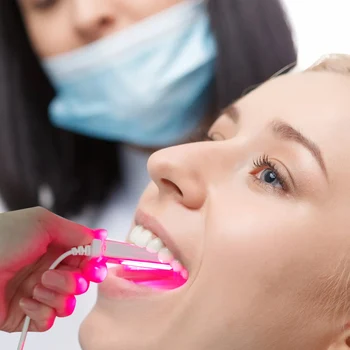 Led ışık Diş Hekimliği Oral Ülser Tedavisi Ekipmanları Anti-inflamatuar Soğuk Boğaz Dudak Ağrı kesici Tedavi