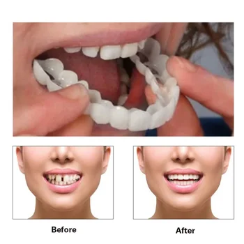 Sahte Diş Kapak Mükemmel Uyum Diş Beyazlatma Yapış Silikon Gülümseme Kaplamalar Diş Dentaduras Esnek Güzellik Aracı Kozmetik