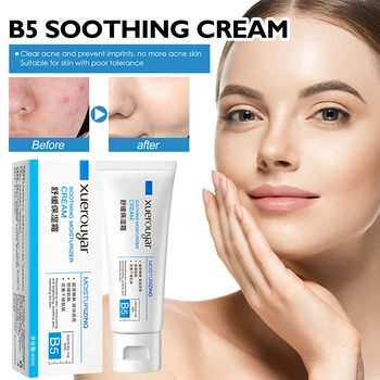 Vitamin B nemlendirici Nemlendirici Yüz Kremi Akne Tedavisi Yatıştırıcı Cilt İnce Çizgileri Azaltır Kızarıklığı İyileştirir Kore Cilt Bakım Ürünleri 40ML